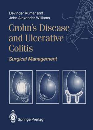 Crohn’s Disease and Ulcerative Colitis: Surgical Management de Devinder Kumar