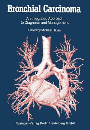 Bronchial Carcinoma: An Integrated Approach to Diagnosis and Management de Michael Bates