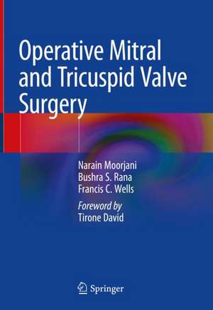 Operative Mitral and Tricuspid Valve Surgery de Narain Moorjani