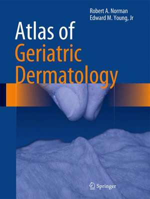 Atlas of Geriatric Dermatology de Robert A. Norman