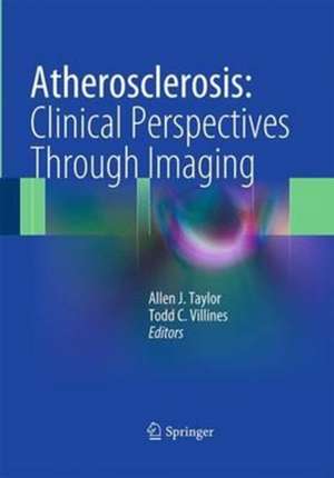 Atherosclerosis: Clinical Perspectives Through Imaging de Allen J Taylor