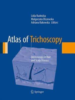 Atlas of Trichoscopy: Dermoscopy in Hair and Scalp Disease de Lidia Rudnicka