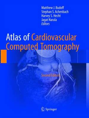 Atlas of Cardiovascular Computed Tomography de Matthew J. Budoff