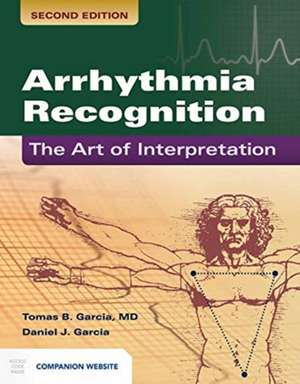 Arrhythmia Recognition: The Art of Interprepation de Tomas B. Garcia