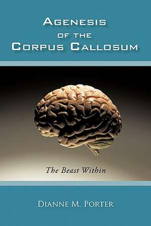 Agenesis of the Corpus Callosum de Dianne M. Porter