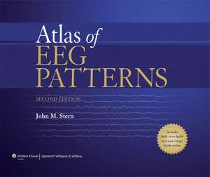 Atlas of EEG Patterns de John M. Stern MD