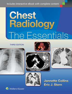 Chest Radiology: The Essentials de Janette Collins