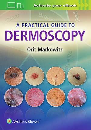 A Practical Guide to Dermoscopy de Orit Markowitz