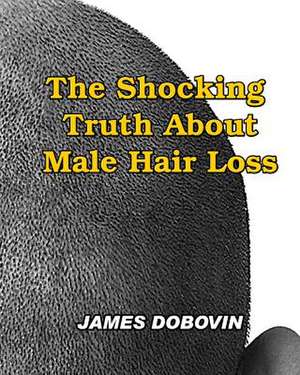 The Shocking Truth about Male Hair Loss de James Dobovin