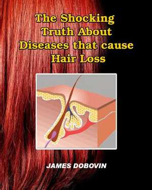 The Shocking Truth about Diseases That Cause Hair Loss de James Dobovin