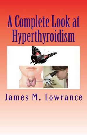 A Complete Look at Hyperthyroidism de James M. Lowrance