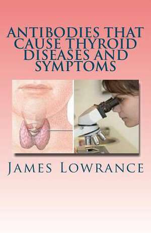 Antibodies That Cause Thyroid Diseases and Symptoms de James M. Lowrance