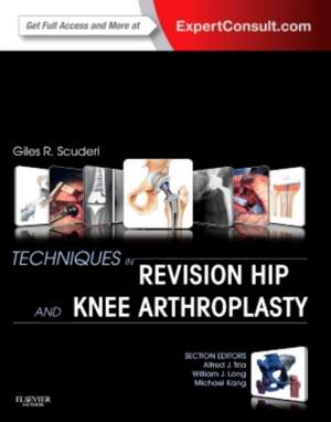 Techniques in Revision Hip and Knee Arthroplasty de Giles R Scuderi