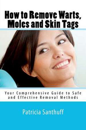 How to Remove Warts, Moles and Skin Tags de Patricia Santhuff