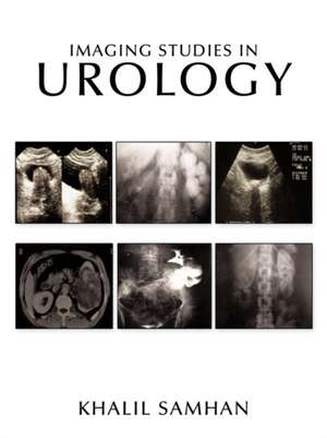 Imaging Studies in Urology de Khalil-Ahmad Samhan