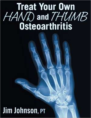 Treat Your Own Hand and Thumb Osteoarthritis de Pt Jim Johnson