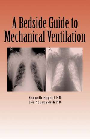 A Bedside Guide to Mechanical Ventilation de Bsn Jessamy Anderson Rn