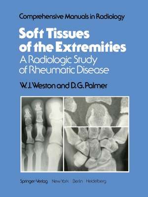 Soft Tissues of the Extremities: A Radiologic Study of Rheumatic Disease de W. J. Weston