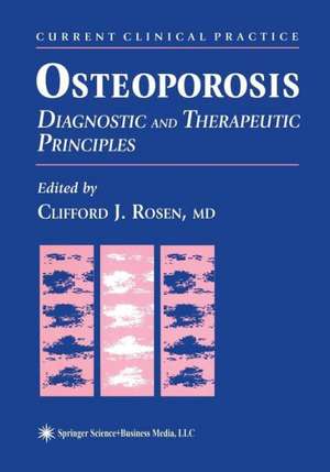 Osteoporosis: Diagnostic and Therapeutic Principles de Clifford J. Rosen