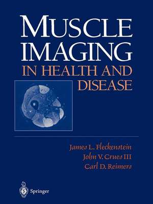 Muscle Imaging in Health and Disease de James L. Fleckenstein