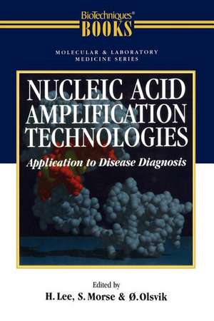 Nucleic Acid Amplification Technologies: Application to Disease Diagnosis de Olsvik