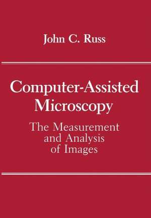 Computer-Assisted Microscopy: The Measurement and Analysis of Images de John C. Russ