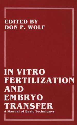 In Vitro Fertilization and Embryo Transfer: A Manual of Basic Techniques de Barry D. Bavister