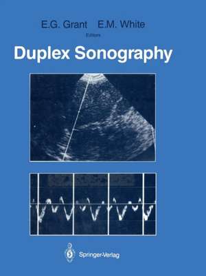 Duplex Sonography de Edward G. Grant