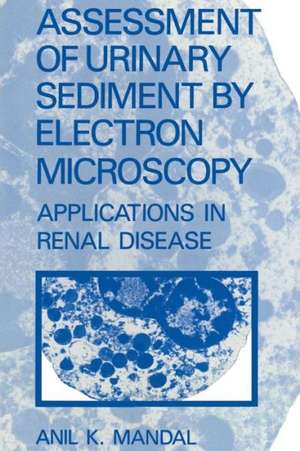 Assessment of Urinary Sediment by Electron Microscopy: Applications in Renal Disease de A.K. Mandal