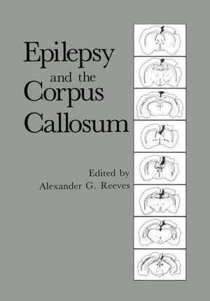 Epilepsy and the Corpus Callosum de Alexander G. Reeves