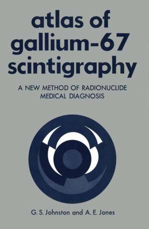 Atlas of Gallium-67 Scintigraphy: A New Method of Radionuclide Medical Diagnosis de Gerald Johnston