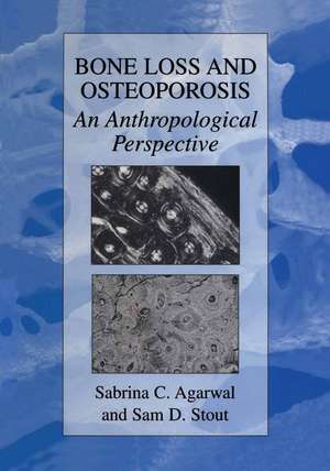 Bone Loss and Osteoporosis: An Anthropological Perspective de Sabrina C. Agarwal