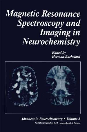 Magnetic Resonance Spectroscopy and Imaging in Neurochemistry de Herman Bachelard