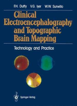 Clinical Electroencephalography and Topographic Brain Mapping: Technology and Practice de Frank H. Duffy