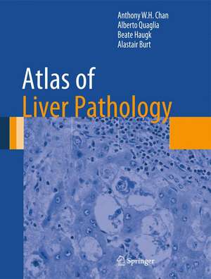 Atlas of Liver Pathology de Anthony W.H. Chan