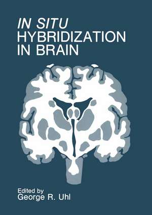 In Situ Hybridization in Brain de George Uhl