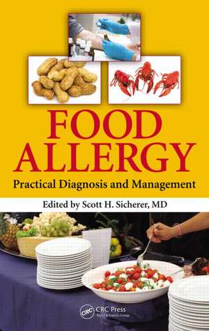 Food Allergy: Practical Diagnosis and Management de Scott H. Sicherer