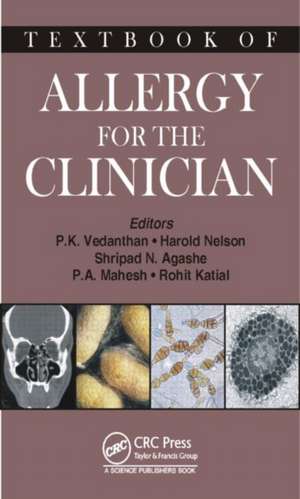 Textbook of Allergy for the Clinician de Pudupakkam K. Vedanthan