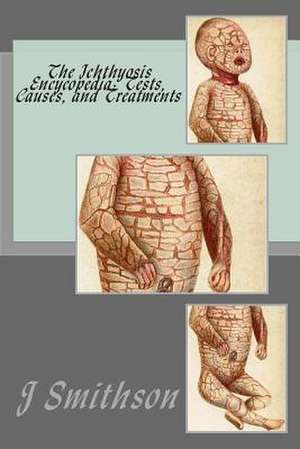 The Ichthyosis Encycopedia de J. P. Smithson Ma