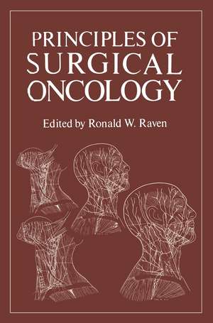 Principles of Surgical Oncology de Ronald Raven