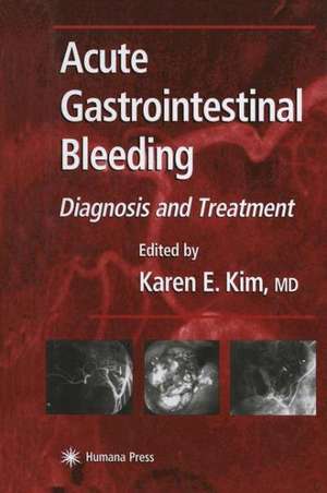 Acute Gastrointestinal Bleeding: Diagnosis and Treatment de Karen E. Kim