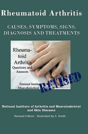 Rheumatoid Arthritis de National Institute of Mental Health