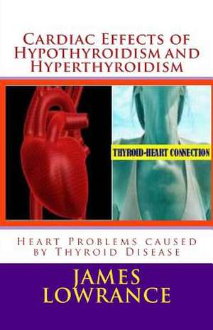 Cardiac Effects of Hypothyroidism and Hyperthyroidism de James M. Lowrance