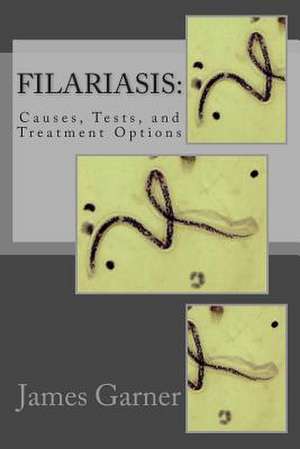 Filariasis de James P. Garner Ma