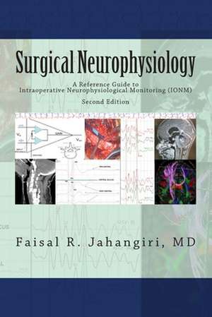 Surgical Neurophysiology - 2nd Edition de Faisal R. Jahangiri