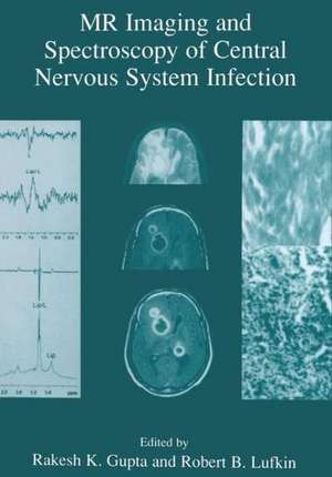 MR Imaging and Spectroscopy of Central Nervous System Infection de Rakesh K. Gupta