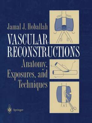 Vascular Reconstructions: Anatomy, Exposures and Techniques de Jamal J. Hoballah