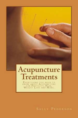 Acupuncture Treatments de Sally Pederson