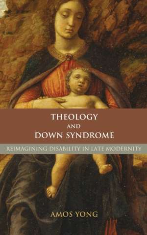 Theology and Down Syndrome de Amos Yong