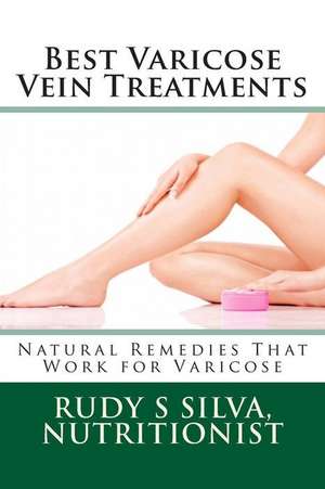 Best Varicose Vein Treatments de Rudy Silva Silva